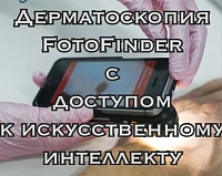 Цифровая дерматоскопия FotoFinder, Германия