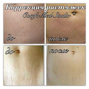 Коррекция растяжек