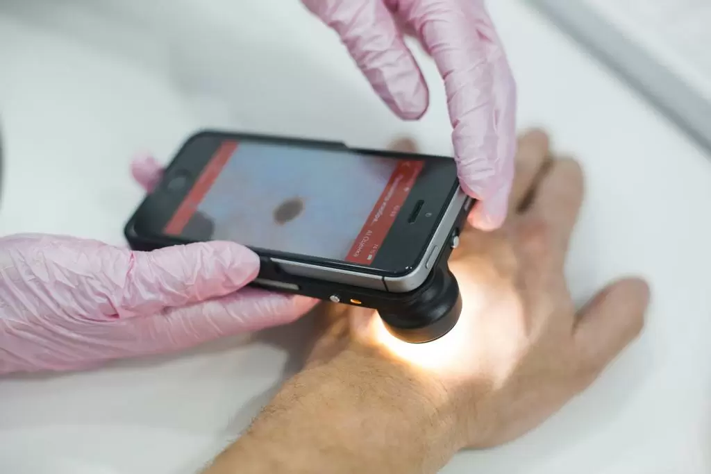 Цифровая дерматоскопия