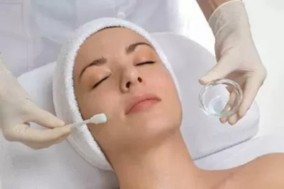 Химический пилинг лица