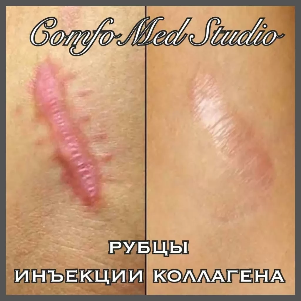 f56a0645_4a86_4577_8b97_3517aeb6c678 (1).webp